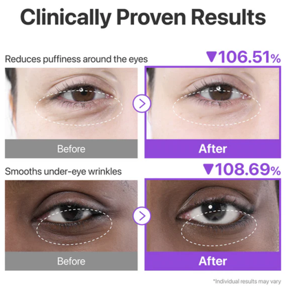 NUMBUZIN No.9 NAD+ Collagen Under Eye Patches 5Pairs